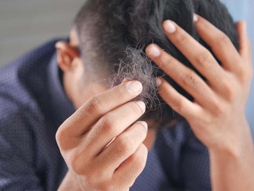 Hair Thinning? Britannia Life Sciences Launches CBD Trial For Hair Loss Therapy