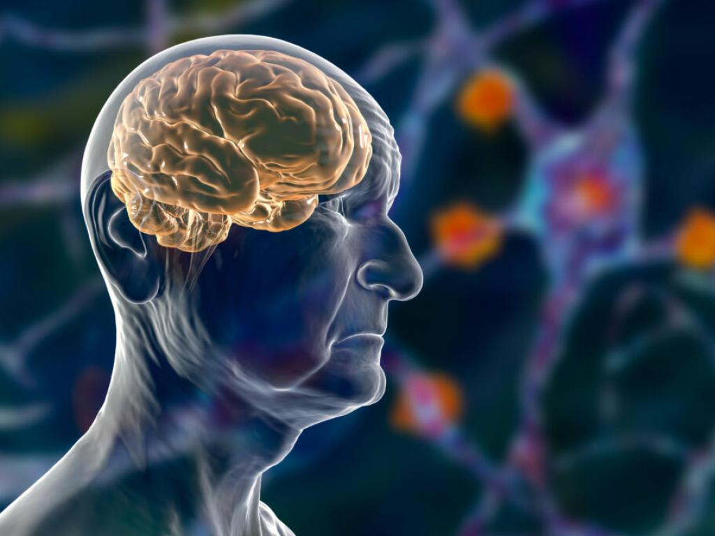  clinical-failure-halts-alectors-dementia-program-company-reduces-workforce 