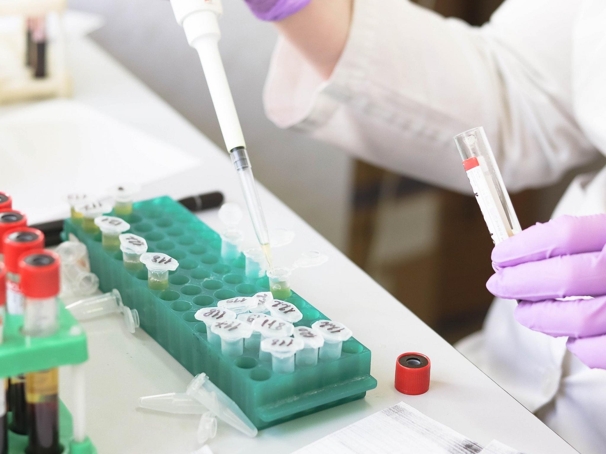  lab-developed-tests-under-fda-scrutiny-what-it-means-for-startups 