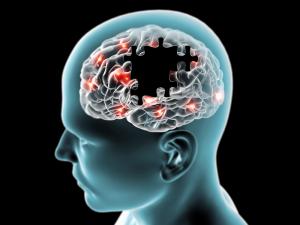 Brain,Degenerative,Diseases,Parkinson,,Alzheimer,,Puzzle