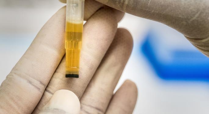 Positive Drug Tests Among US Workers Higher Than In Last 20 Years; Does That Include Cannabis?
