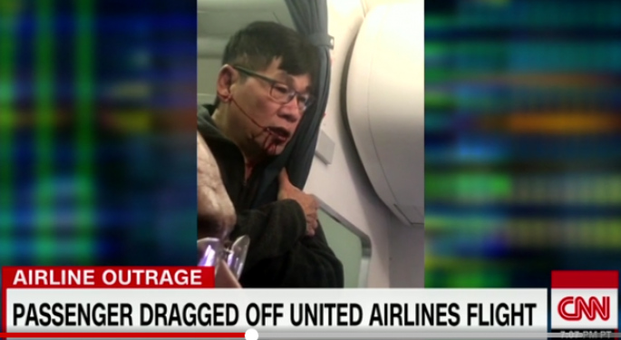 Pummeled United Passenger Suffered Concussion, Broken Nose; Will Likely Sue