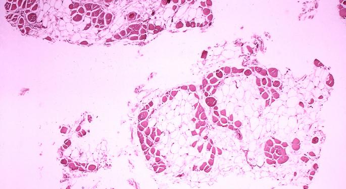 Why Wave Life Sciences's Valuation Is Falling By 25%