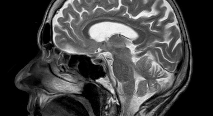 Mallinckrodt Shares Trending Upward On Positive Multiple Sclerosis Outlook