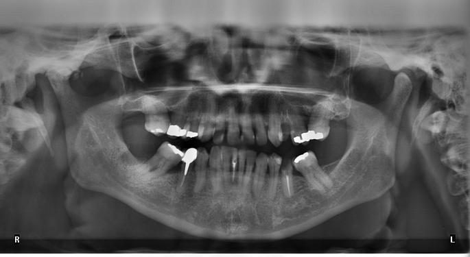 BofA Expects Dentsply Sirona's Performance To Improve With New Product Ramp, Cost-Cutting