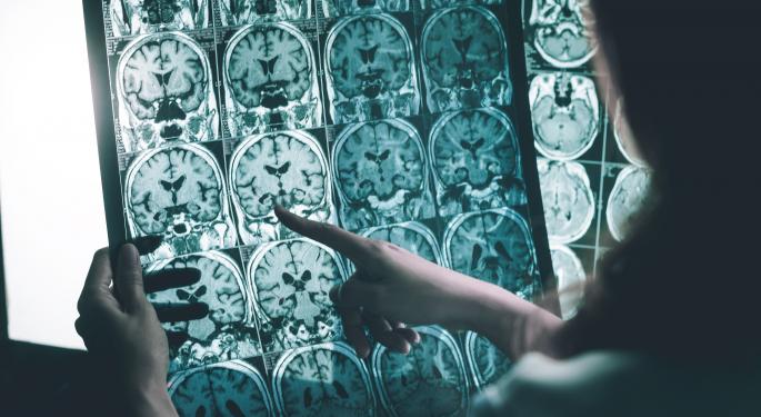 Flu Shots Can Cut Down Risk Of Alzheimer's, Exploratory Study Finds