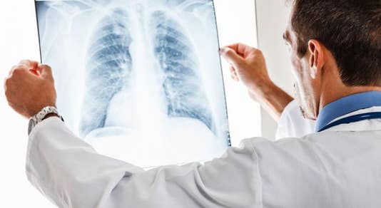 FDA aprueba Imdelltra de Amgen para cáncer de pulmón
