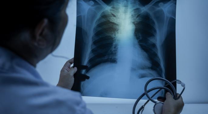 Kansas City Battles Major Tuberculosis Outbreak, 67 Active Cases, Hundreds Under Watch